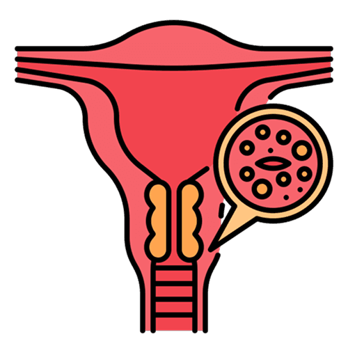 Cervical cancer