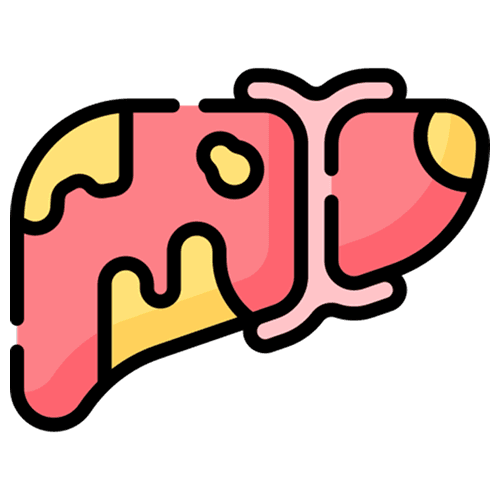 Non-Alcoholic Fatty Liver Disease